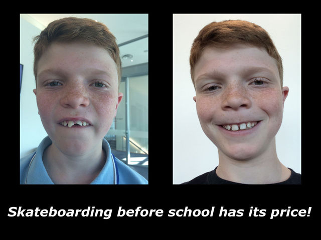 Robert_s_teeth.jpg